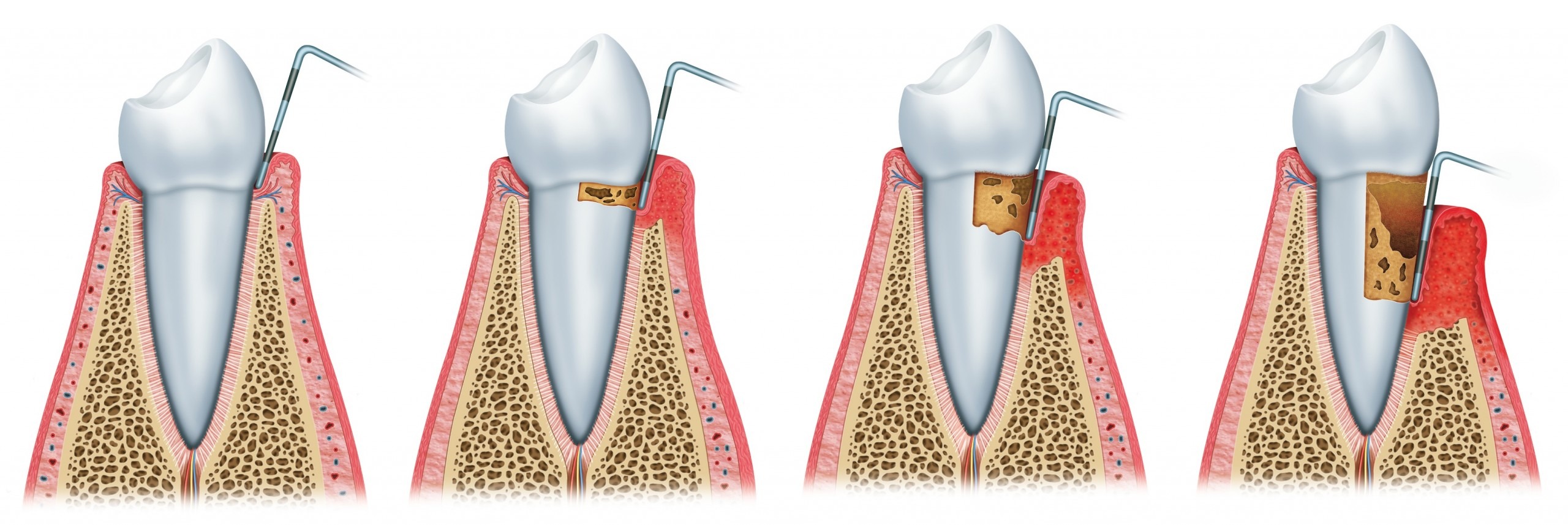 Periodontologia Tratamentos CMO Clinic Barreiro