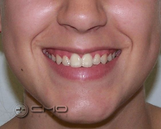 tratamento ortodontia