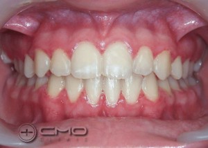 tratamento ortodontia