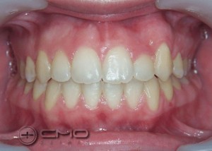 ortodontia depois