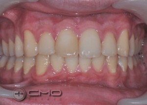 ortodontia - novo sorriso