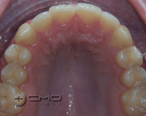 ortodontia depois