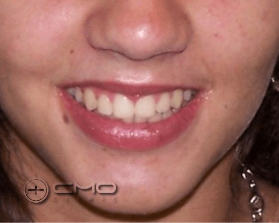 correção dos maxilares e dentes
